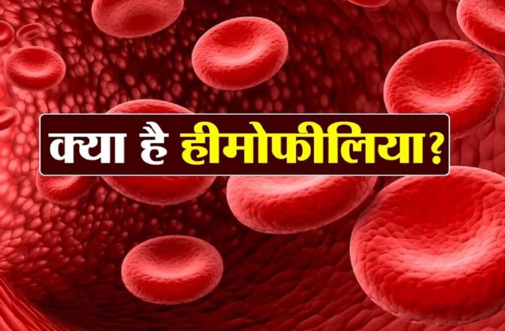 HemophiliaSymptoms