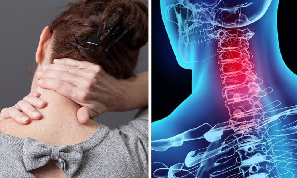 NeckCrackingDangers : सावधान – गर्दन चटकने की आवाज हल्के में न लें ! NeckCrackingDangers