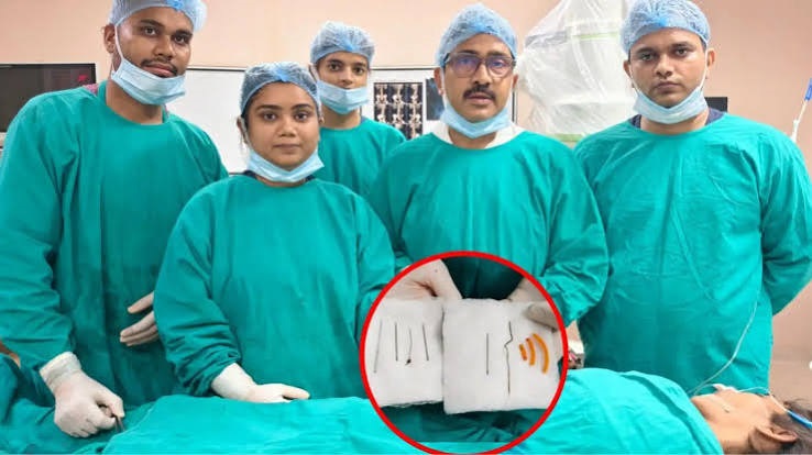 MedicalNews : महिला के पेट से निकलीं सुई, चूड़ी और हेयर पिन UPNews
